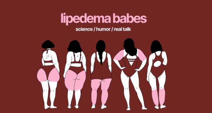 lipedema babes