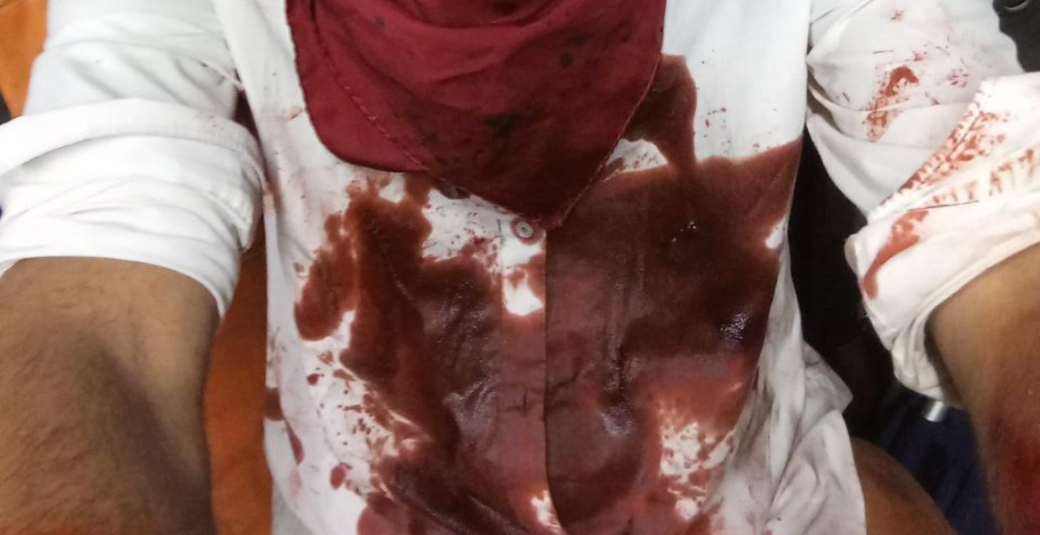Prop Making – Fake Blood & Other Disgusting liquid