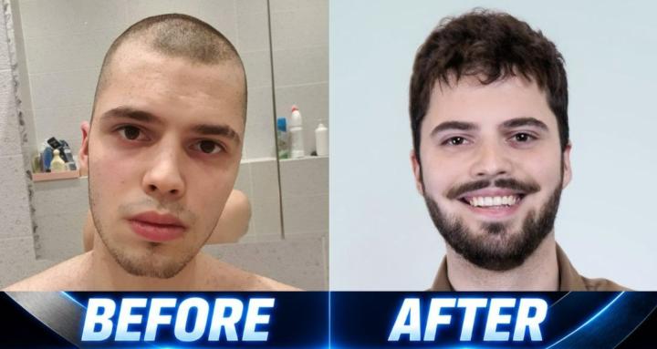 Hair System: Done Right