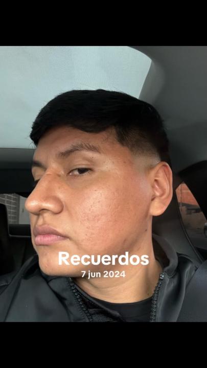 Fredy Ninaja