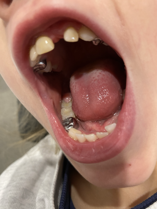 Teeth