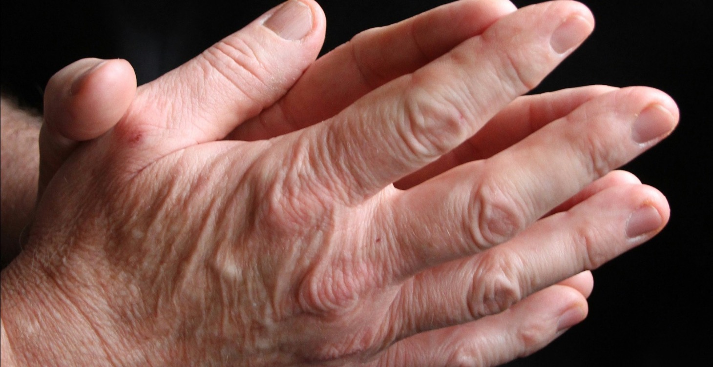 DEMENTIA & ALZHEIMER'S