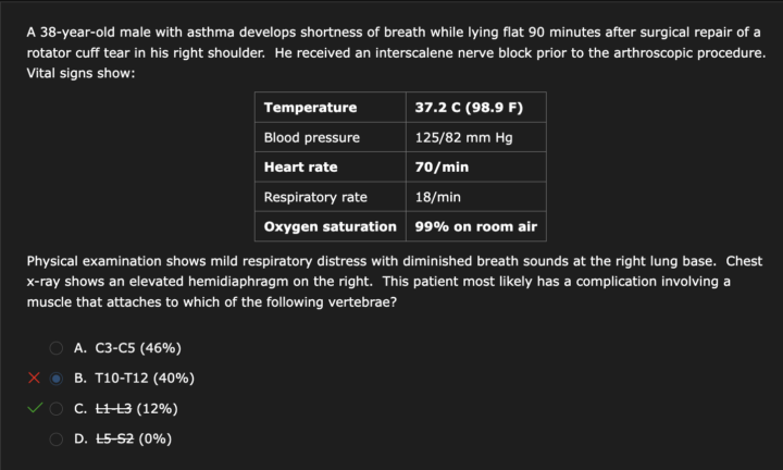 Practice question