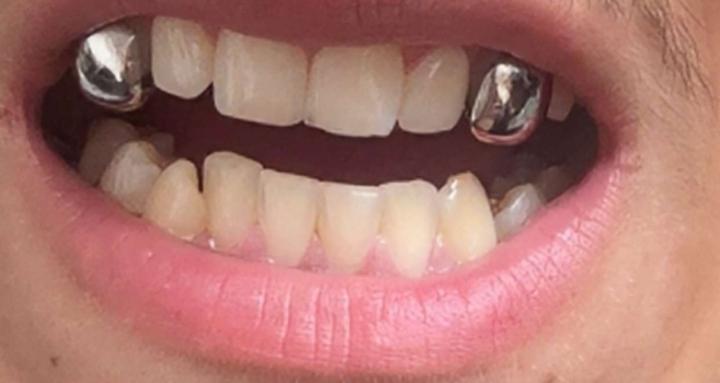Grillz by Dee Dee