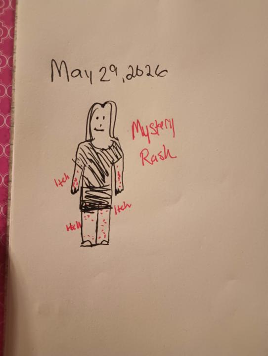 5/29