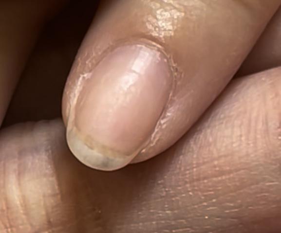 為何你卸完甲面凹凸不平的３個關鍵要點