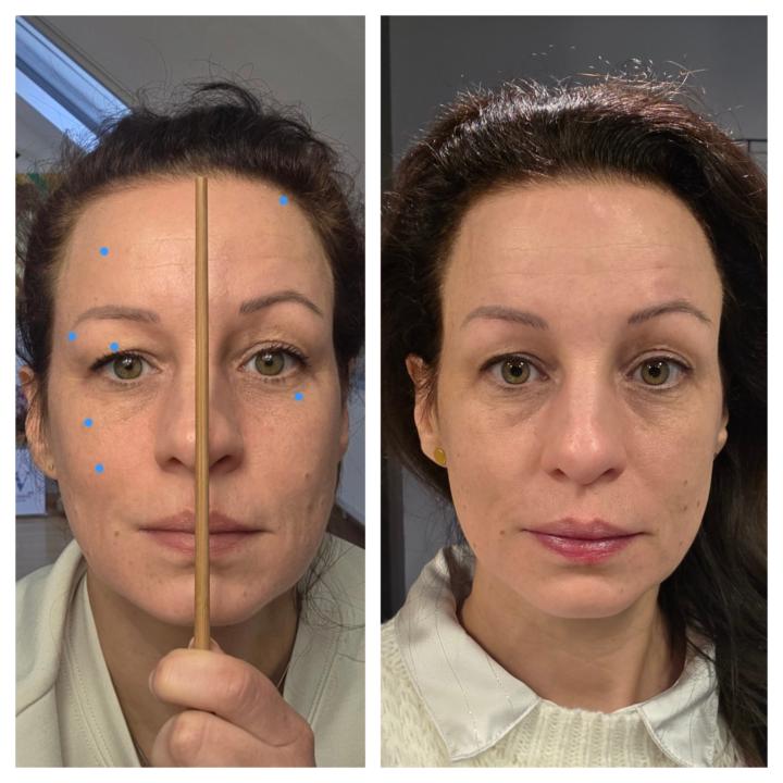 12 day update.