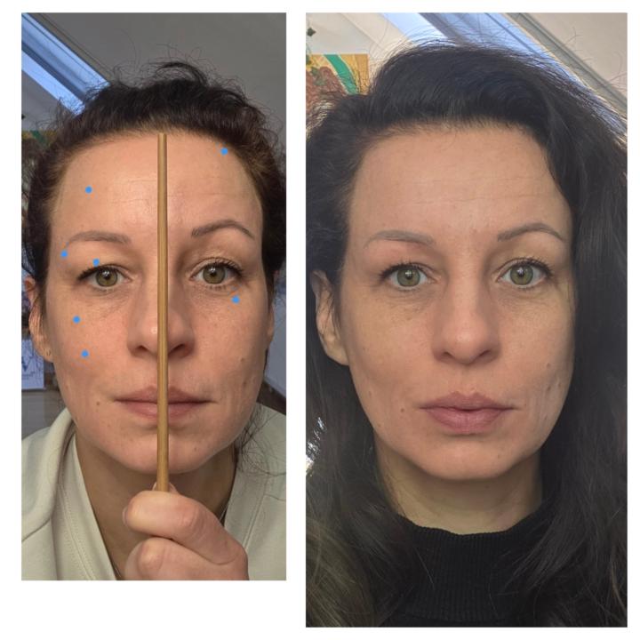 4 weeks using the Horizon beauty tool.