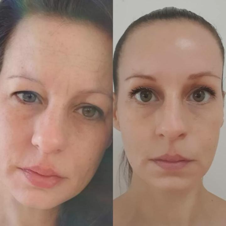 Meine Face-Yoga-Reise begann mit Skepsis.