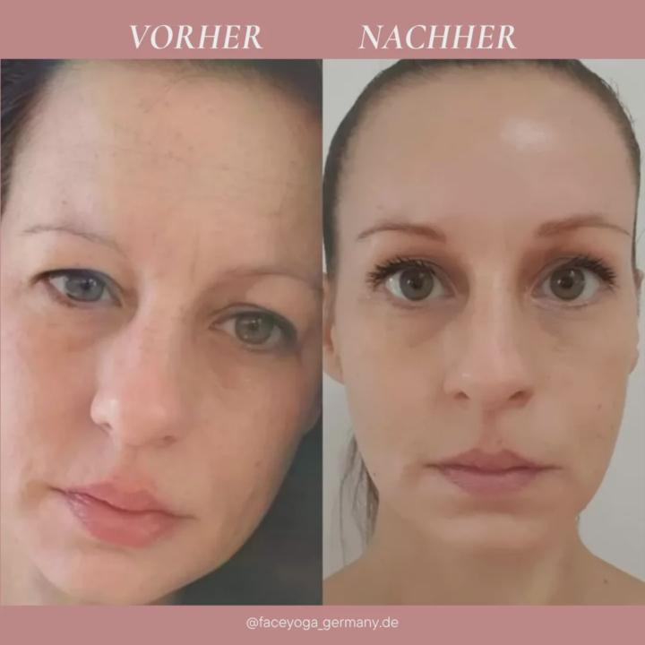 My Face Yoga journey began with skepticism.