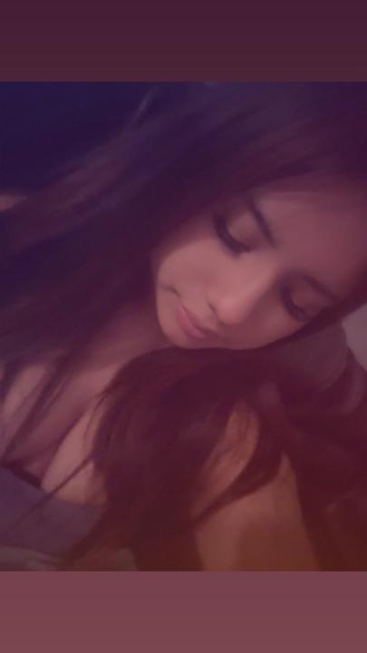 Anavella diarez Dirze