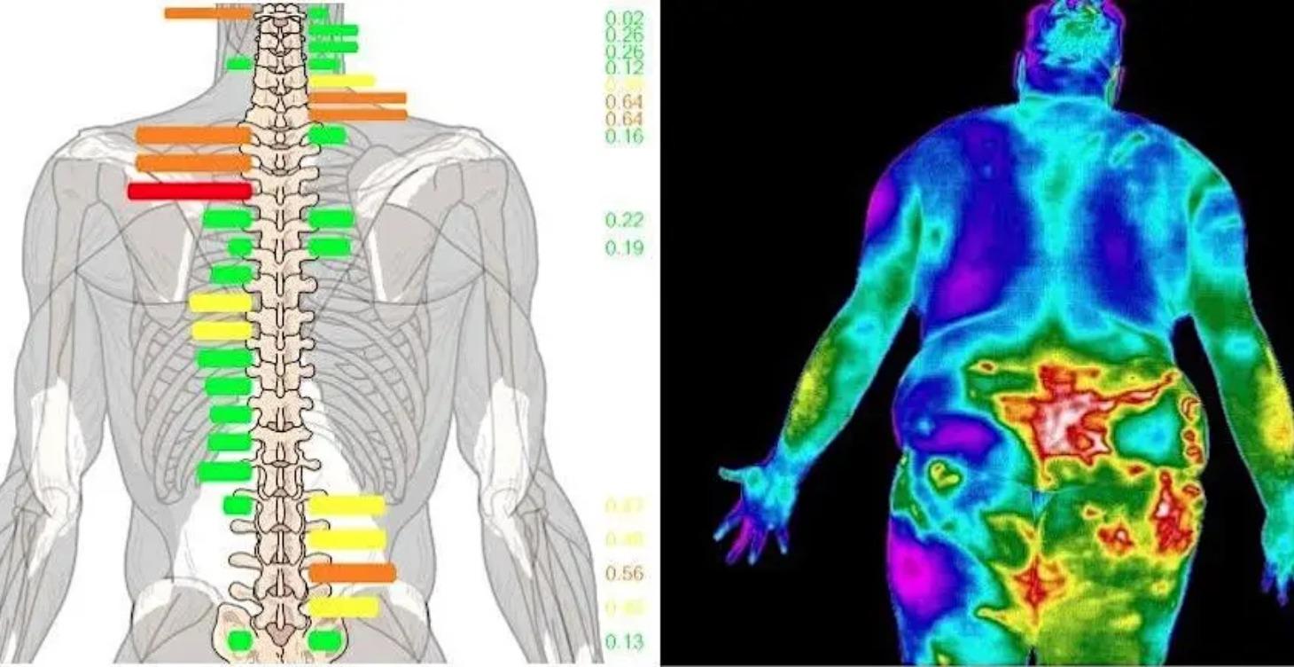 The HARD Way: Intro to Chiropractic Thermography