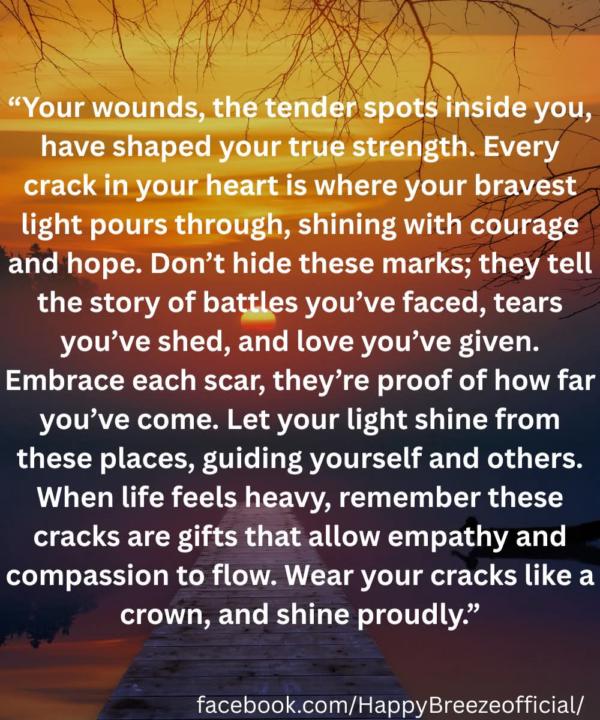 Wear your cracks like a crown, proudly.