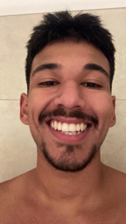 Aaron Torres
