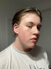 Lucas Bradley