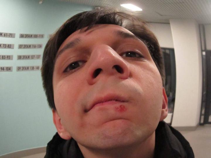Maratilla Apxit