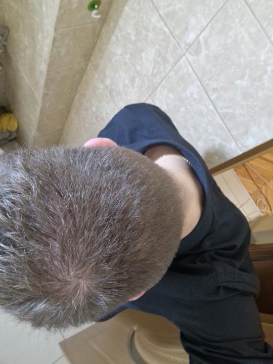 My hair type