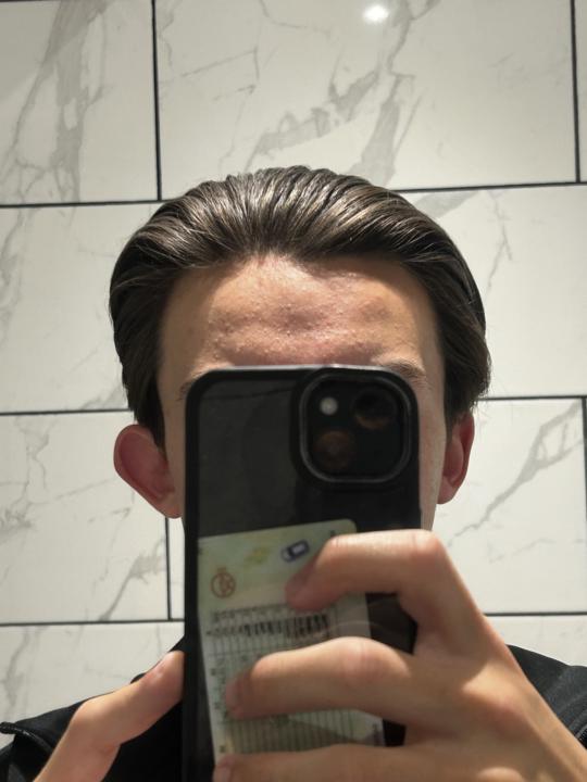 Dry hair