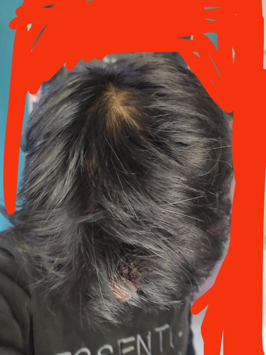 Help me identify my hair type