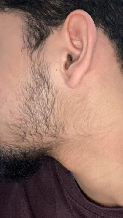 Do I need to trim my beard?