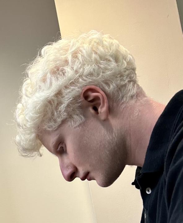 Albino beauty 