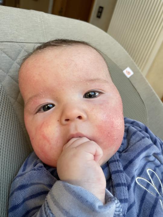 Peau bébé 