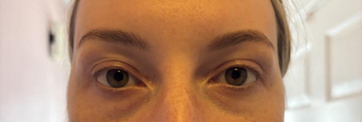Lash lift 