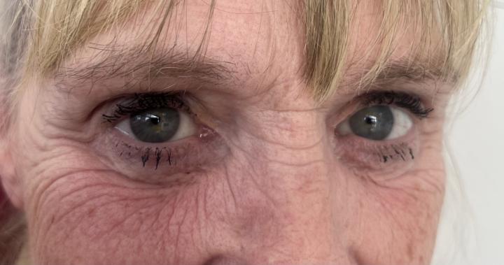 Rod sizing help for low brow bone