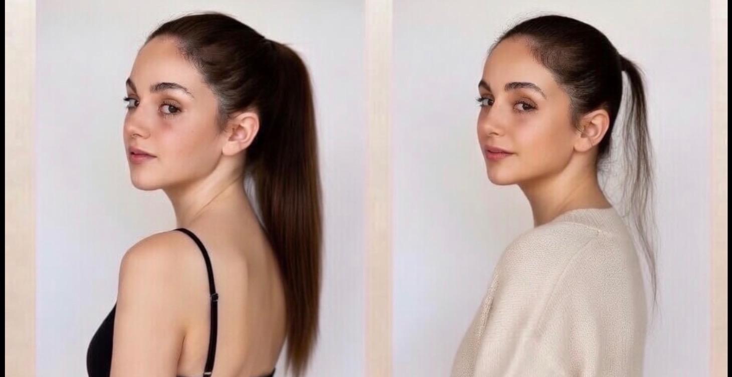 ¿Caída de pelo o alopecia? No te preocupes..