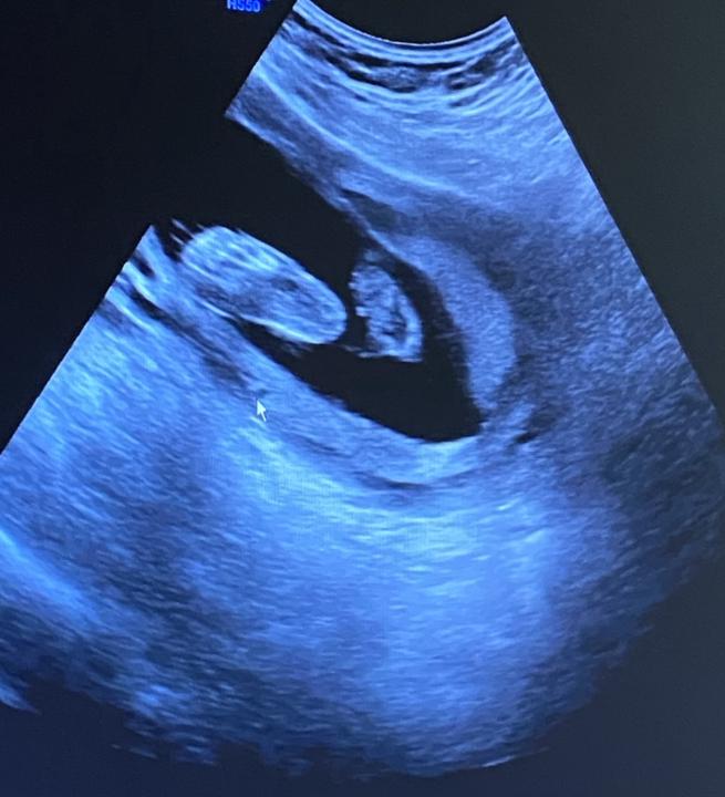 Celebrating milestones 