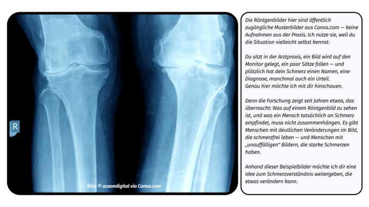 Was sagt (d)ein Röntgenbild eigentlich?