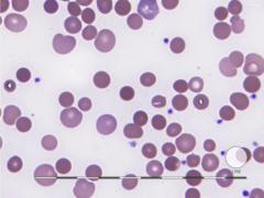 Tomás Pérez Ramirez