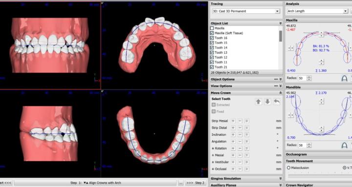 Next-Level Aligner Business