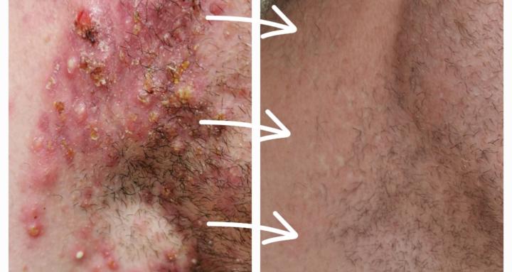 Save Your Own Skin