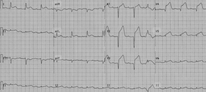 ❓ Quick Quiz: ECG Challenge