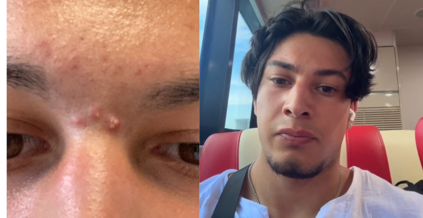 Skincare Glowup Protocol