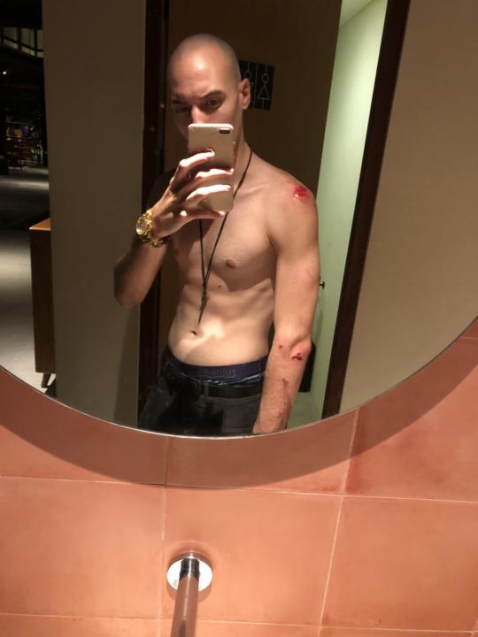 Raw Tribal Accident at Canggu Bali