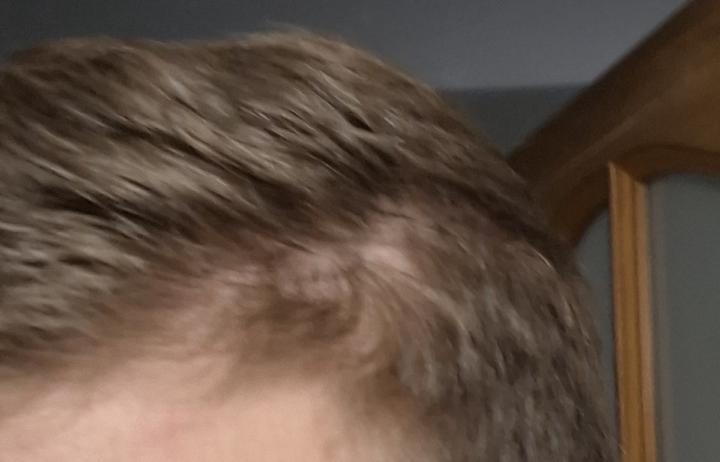 How to deal with bold spots ?