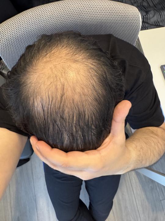 1 month update!