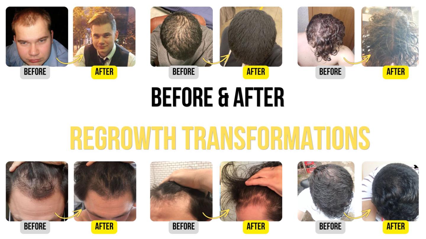 The Rapid Regrowth Community