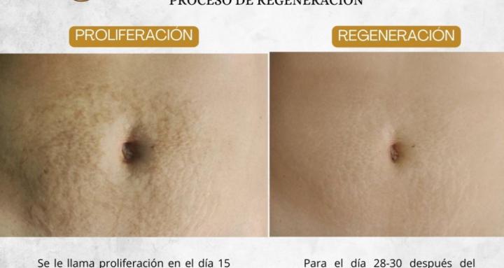 Stria Expert Academy