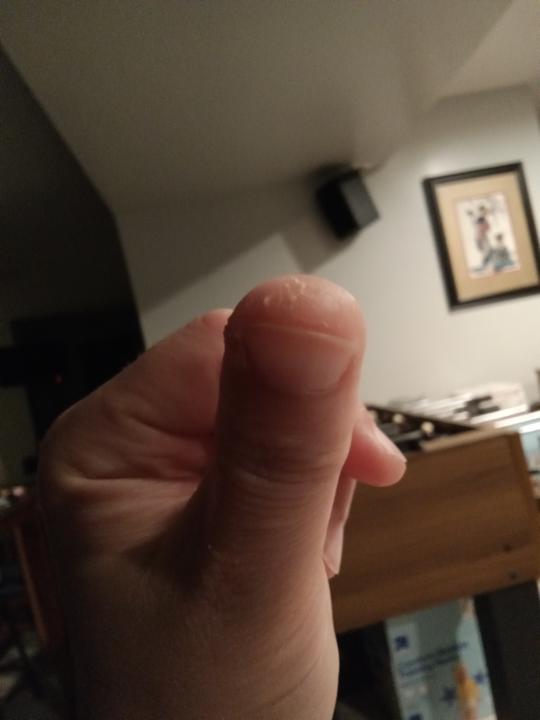 Thumb pulling confusion