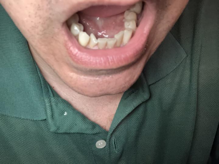 One year results 