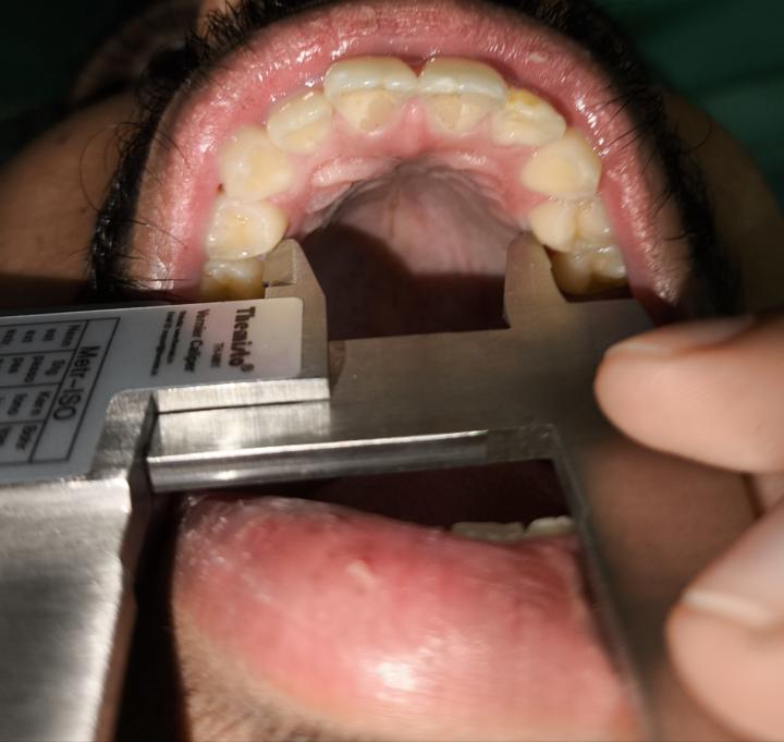 Did I measure it correctly?