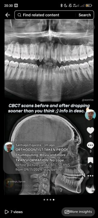 Talk about breaking the internet. ;) 