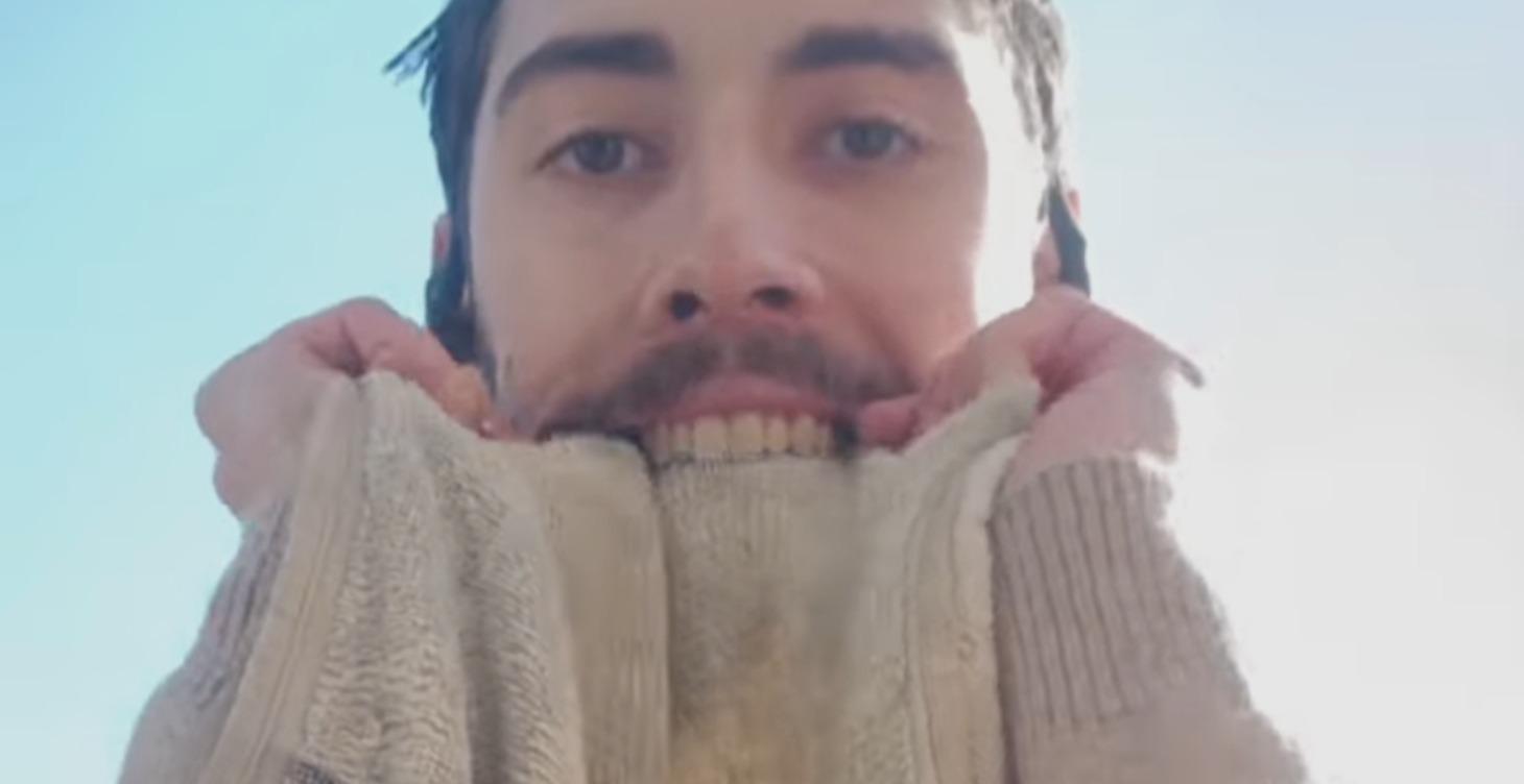 Histo-stretching/Fast method