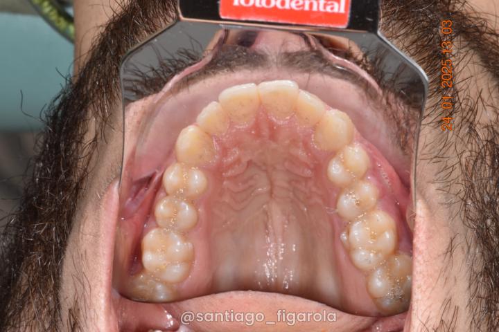 Should I post pics of my palate progression next?