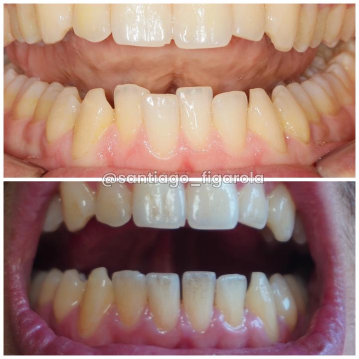 Something very *special*...