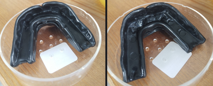 Mouthguard tooth pressure & pain