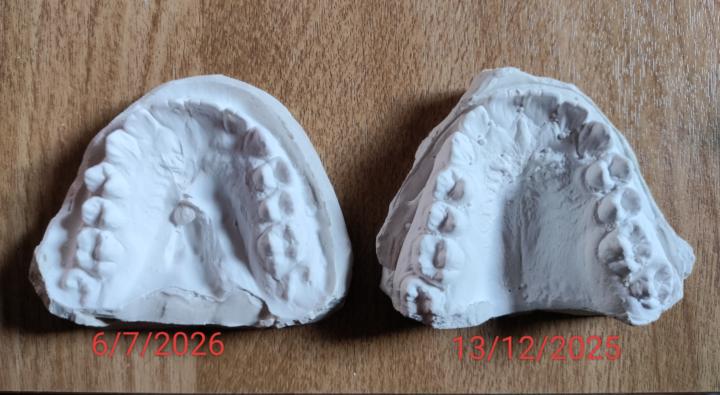 Palate transformation